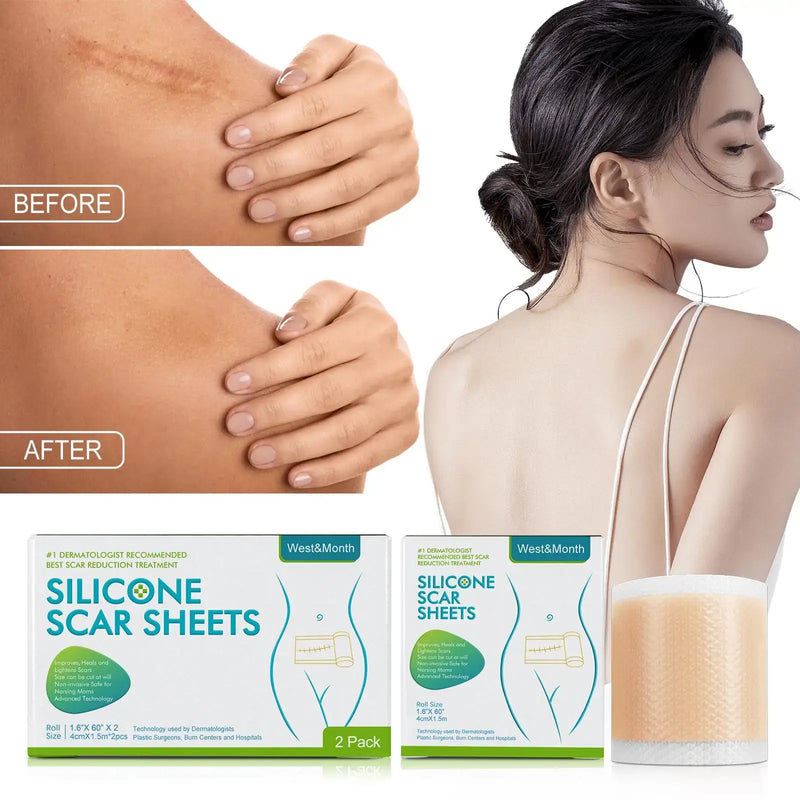 Silicone Scar Patch Skin Repair Sheets Removal Self-Adhesive Stretch Mark Tape Therapy Patch Burn Acne Scar Skin Care