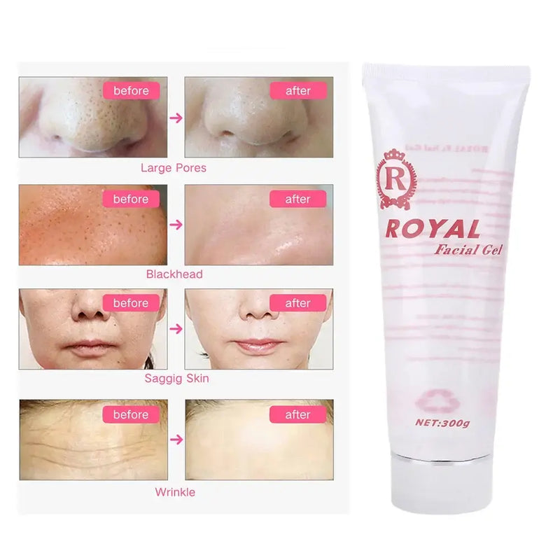 Freezing Cool Gels Hair Removal Cream for Laser Acupoint Pen Equipment Skin Face Beauty Care Body Slimming Massager Women Men